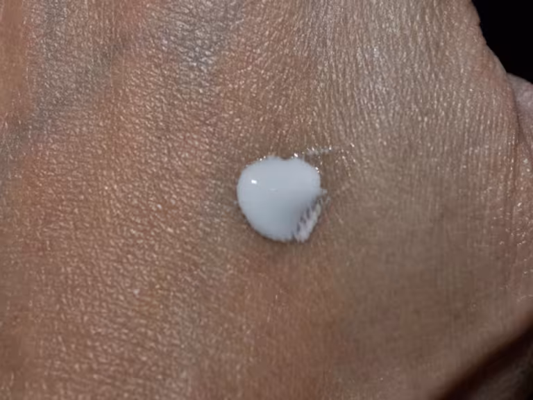 forest air eczema relief